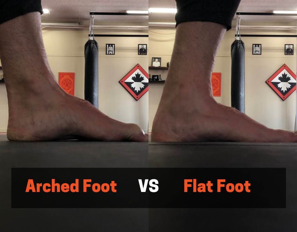 Flat feet might cause shin splints while squatting