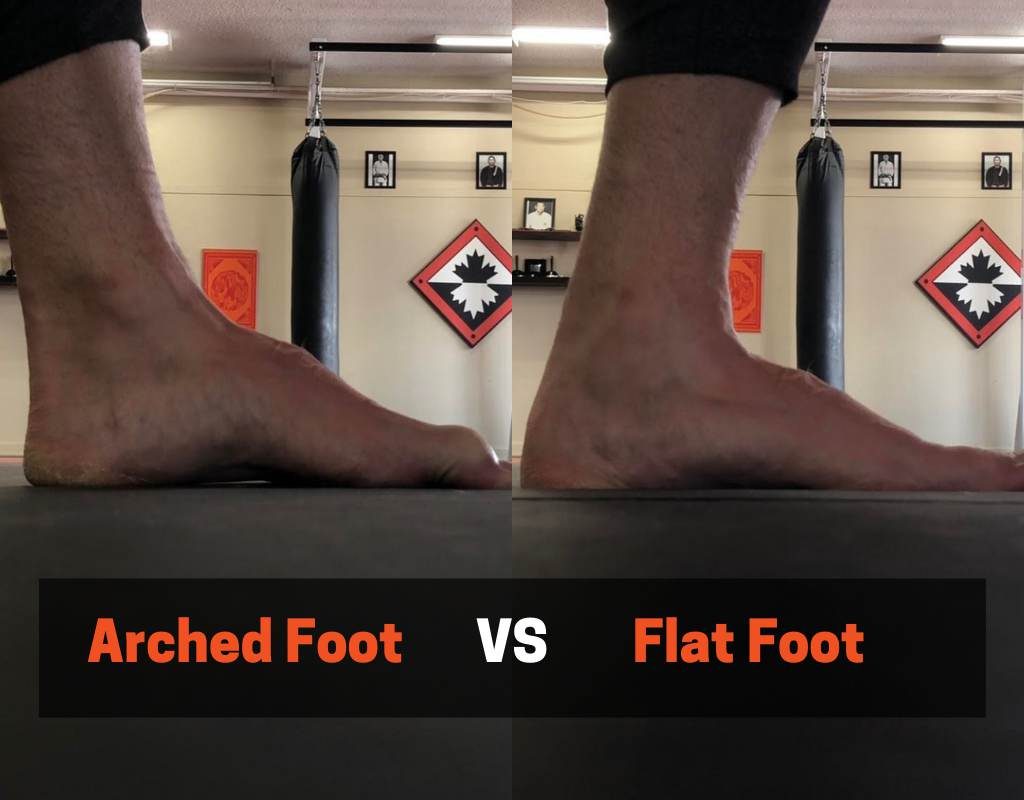 flat foot disadvantages