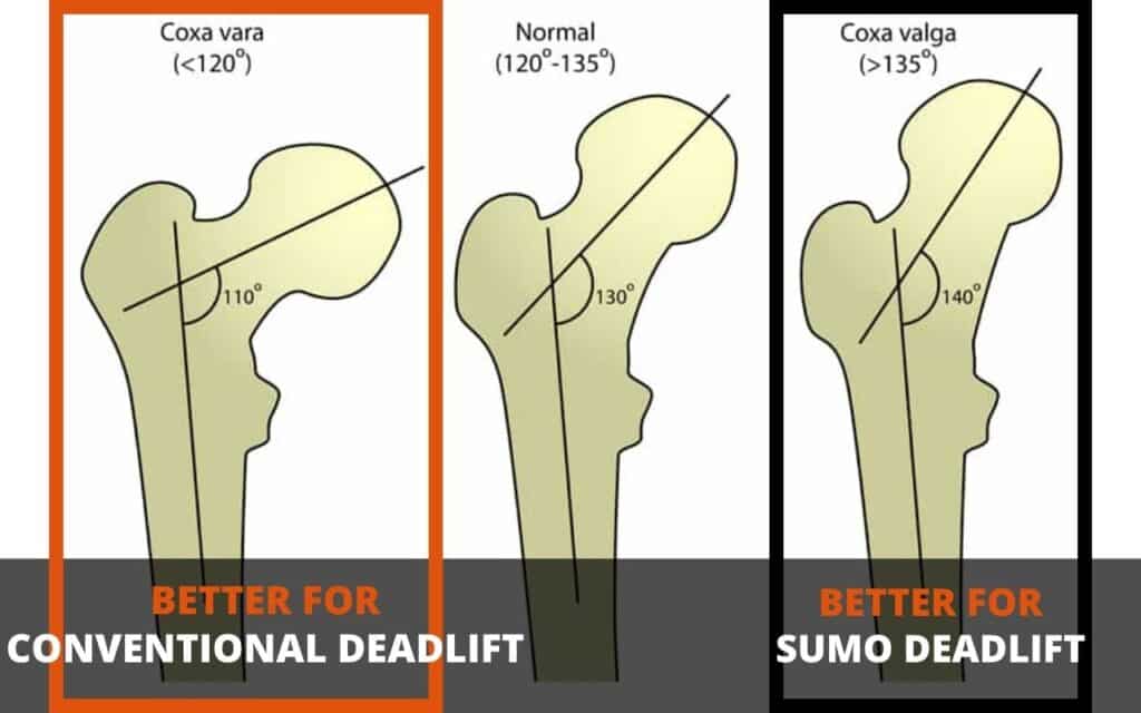 If your hip angle is low, then conventional deadlifts are better. If your hip angle is large, then sumo deadlifts are better.