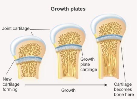 Growth plates and squatting