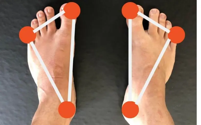 Flat feet while squatting