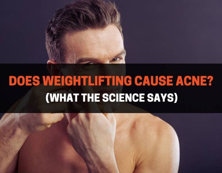 Does Weightlifting Cause Acne