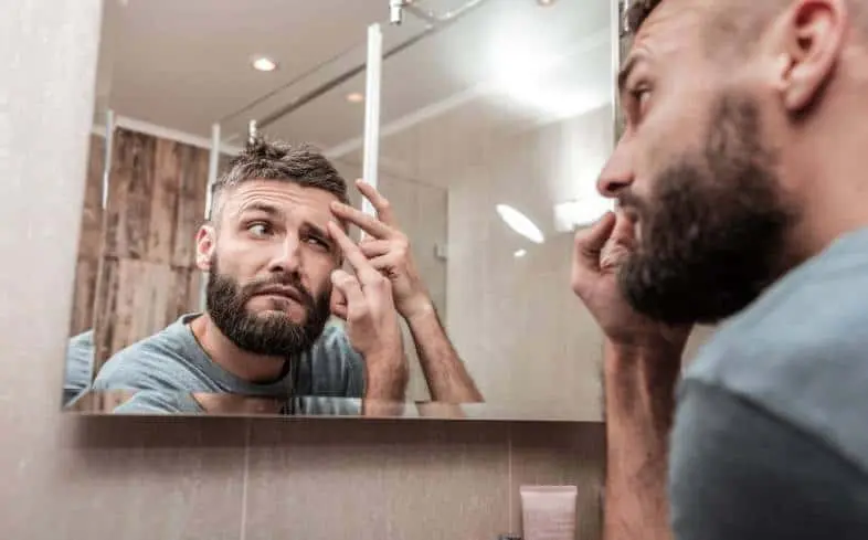 some things that you can do if you already have acne