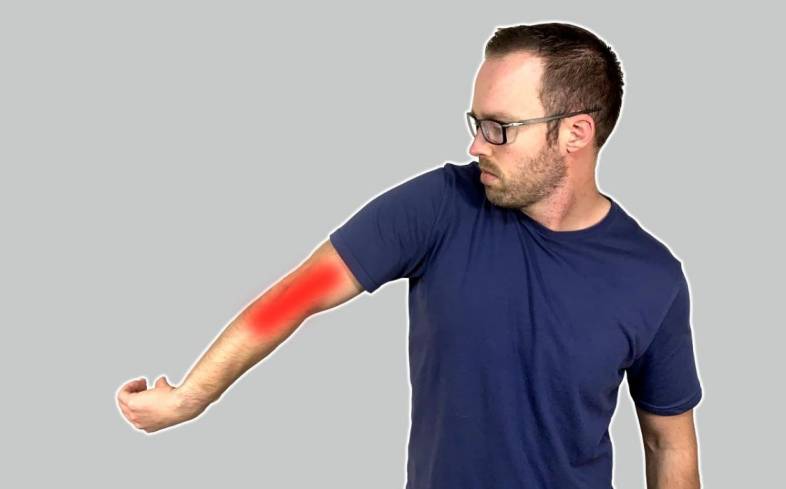 lateral epicondylitis, often referred to as tennis elbow