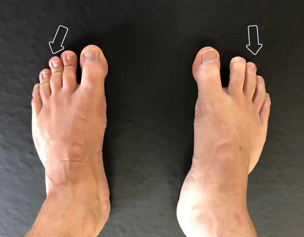 check your foot pressure in squatting
