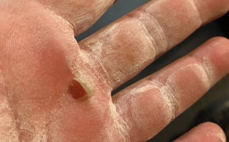 how-to-deal-with-calluses-from-lifting-5-tips-powerliftingtechnique