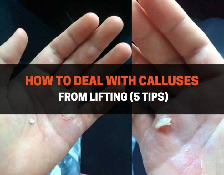 How To Deal With Calluses From Lifting