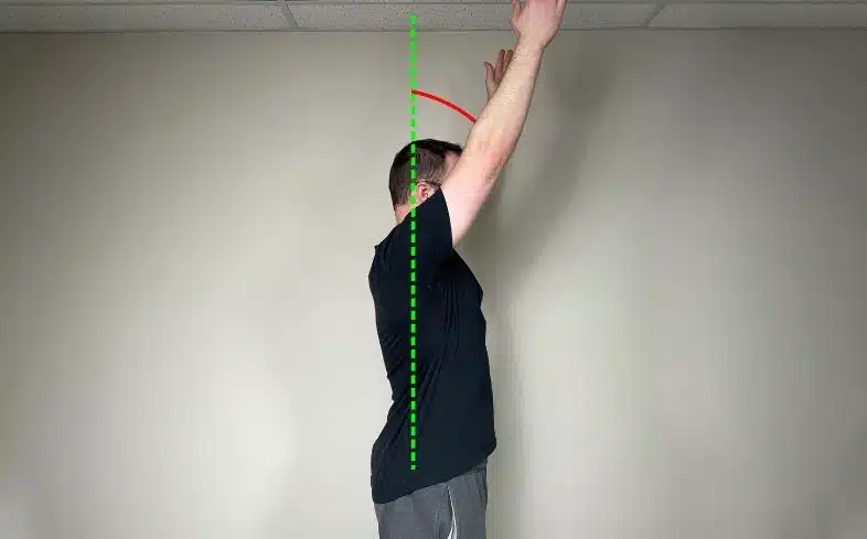 lack shoulder flexion